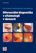 Největší obrázek výrobku Diferenciální diagnostika v oftalmologii v obrazech Svozílková Petra a kolektiv Největší obrázek výrobku Diferenciální diagnostika v oftalmologii v obrazech Svozílková Petra a kolektiv