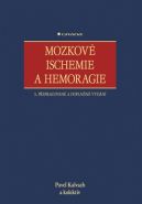 Nejv�t�� obr�zek v�robku Mozkov� Ischemie a Hemoragie kolektiv
