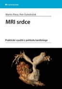 Největší obrázek výrobku MRI srdce - praktické využití z pohledu kardiologa Pleva Martin, Ouředníček Petr Největší obrázek výrobku MRI srdce - praktické využití z pohledu kardiologa Pleva Martin, Ouředníček Petr