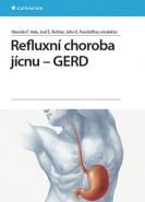 Nejv�t�� obr�zek v�robku Refluxn� choroba j�cnu - GERD Vela Marcelo F., Richter Joel E.