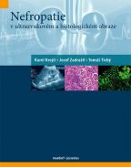 Nejv�t�� obr�zek v�robku Nefropatie v ultrazvukov�m a histologick�m obraze kolektiv autor�