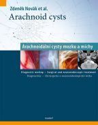 Největší obrázek výrobku Arachnoid cysts - Arachnoidální cysty mozku a míchy Novák Zdeněk Největší obrázek výrobku Arachnoid cysts - Arachnoidální cysty mozku a míchy Novák Zdeněk