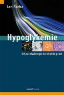 Nejv�t�� obr�zek v�robku Hypoglykemie - Od patofyziologie ke klinick� praxi �krha Jan
