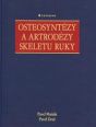 V�ce informac� o v�robku Osteosynt�zy a artrod�zy skeletu ruky