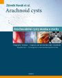 V�ce informac� o v�robku Arachnoid cysts - Arachnoid�ln� cysty mozku a m�chy